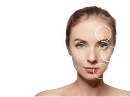 Терапия акне - фото